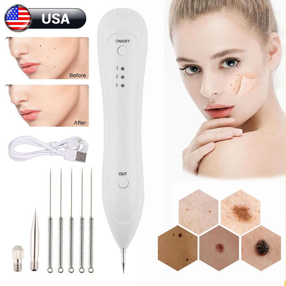 Electric Laser Plasma Pen Kit Mole Removal Dark Spot Remover Skin Wart Tattoo